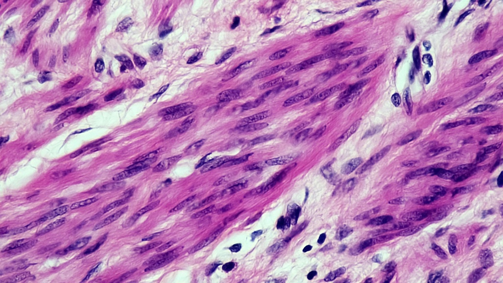 Human Mammary Epithelial Cells, Male   -1 vial